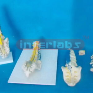 HUMAN CAUDA EQUINE AND ACANTHA NERVE IN LUMBAR AND SACRUM.