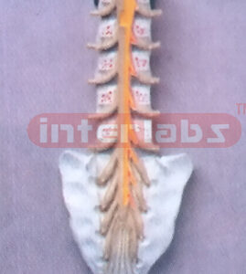 HUMAN CAUDA EQUINE IN LUMBAR AND SACRUM