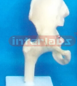 GENERAL BIG L-HIP JOINT FUNCTIONAL MODEL
