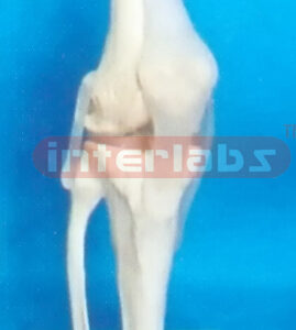 GENERAL BIG L-KNEE JOINT FUNCTIONAL MODEL