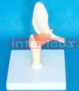 MIDDLE HIP JOINTFUNCTIONAL MODEL