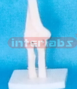 BIG ADULT HUMAN ELBOW JOINT