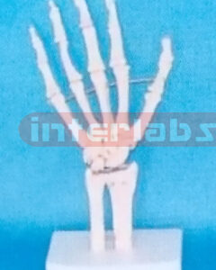 BIG ADULT HUMAN ARM JOINT