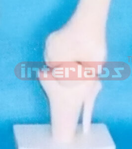 BIG ADULT HUMAN KNEE JOINT