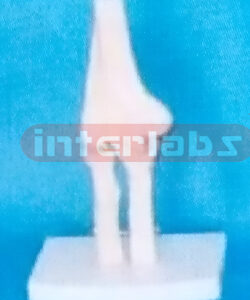 SMALL ADULT HUMAN ELBOW JOINT