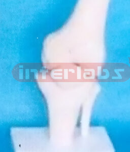 SMALL ADULT HUMAN KNEE JOINT