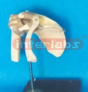 ADVANCED BIG L-SHOULDER JOINT FUNCTIONAL MODEL (ASIA)