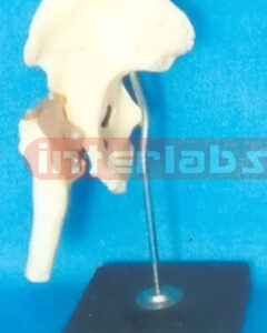 ADVANCED BIG L- HIP JOINT FUNCTIONAL MODEL (ASIA)