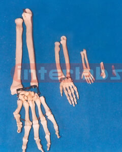 ADULT HAND BONE WITH RAPLUS AND ULNA