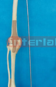 BIG ADULT LEG BONE WITH INNOMINATE BONE AND THREE JOINTS WITH LIGAMENTS