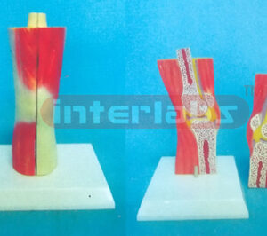 NATURAL SECTION MODEL THROUGH THE KNEE JOINT WITH MUSCLES