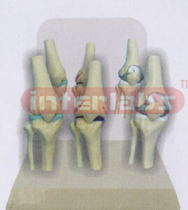 DESK-TYPE, DISEASE FIXED JOINTS MODEL WITH DESCRIPTION PLATE