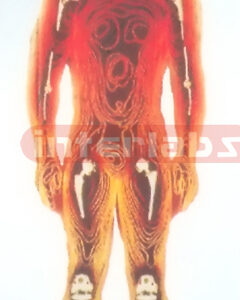 HUMAN CT MODEL