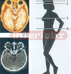 ANATOMICAL DISL MODEL OF FEMALE HUMAN TORSO Section 2