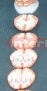 ANATOMICAL MODEL OF BRAIN(TRANSVERSE HORIZONTAL) SECTION
