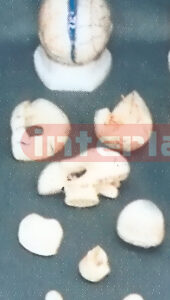 CORONAL BRAIN MODEL (9 PCS)