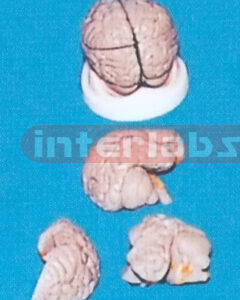 GREY BRAIN ON BASE