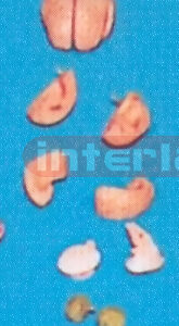 MIDDLE PINKISH BRAIN ON BASE (8 PCS)