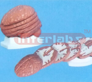 16 x 12.5 x 15 cm TRANSVERSE PLANE SECTION OF BRAIN NUMBERED With BASE (5PCS)
