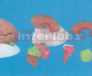 PINKISH BRAIN ON LUXURY BASE