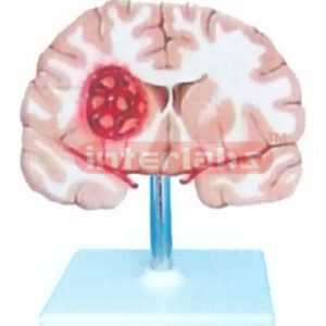 BRAIN MODEL BY SMOKE STROKING AND WIDESCRIPTION PLATE