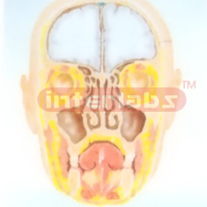 HUMAN PARANASAL SINUSES MODEL