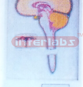 ELECTRIC CONDUCTION OF L1GUOR CEREBROSPINALIS CIRCULATION MODEL
