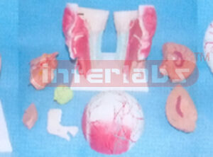 BIG HEAD SECTION MODEL