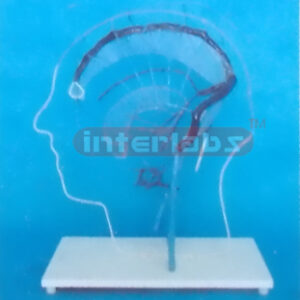 SOLID CONFIGURATION OF MAGNIFIED ENCEPHALIC OUTER VEIN ANASTOMOSIS
