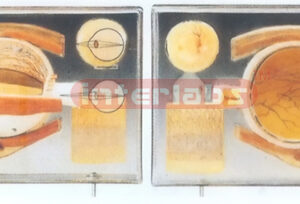 EYE DEMONSTRATION PLATE