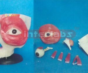 THE AUTOPSY OF THE EYEBALL, LACRIMAL, ORBIT AND EYELID 30 x 28 x 23 cm