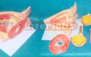 COLOURED EYE MODEL WITH ORBIT, EYE LID EYE MUSCLE AND EYE NERVES