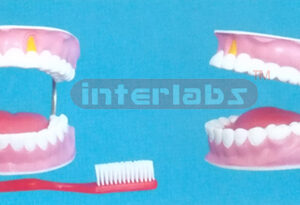 FEATHEREDGE GIANT DENTAL CARE MODEL WITHOUT TOOTH GAP FIXED WITH TONGUE (ORAL HYGIENE SET, UP & LOWER JAW) (28PCS)