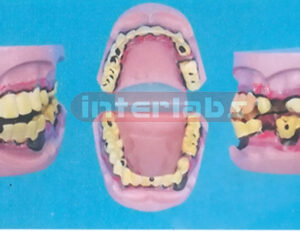 SMOKELESS TOBACCO MOUTH MODEL