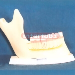 ADULT MANENTTEETH