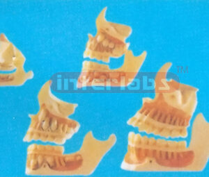 DEVELOPMENT OF A SET OF TEETH
