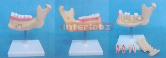 MINI MANENTTEETH AND LOWER JAW (MINI DELUXE TEETH AND JAW MODEL)