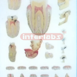 HANGING HUMAN DEMONSTRATING MODEL OF THE TEETH AND JAW