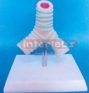 ASTHMA DISEASE BRONCHI MODEL