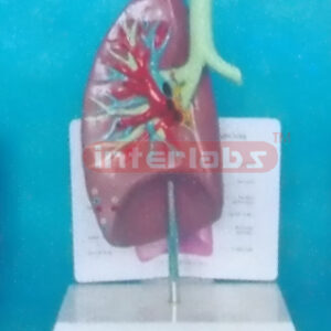 ANATOMICAL TRACHEA / LUNG MODEL WITH DESCRIPTION PLATE