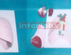 NATURAL LUNG MODEL CONTAINS LARYNX, LUNGS, TUBES, HEART