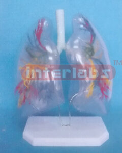 30x26x16cm TRANSPARENTPULMONARY SEGMENTS, VISIBLE TRACHEA, BRONCH I/BRONCHO