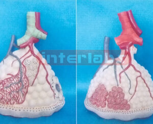 MAGNIFIED LUNG LOBULE MODEL WITH PULMONARY ALVEOLI