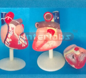 MIDDLE MAGNIFIED HEART, MODEL ASIASTYLE,(2PCS)