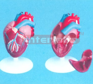 MIDDLE ANATHEART MODEL (4 PCS)