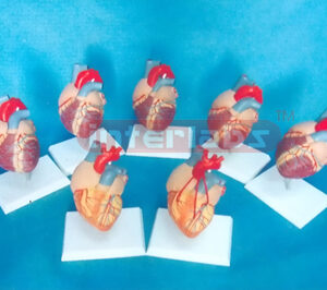 HUMAN HEART MODEL OF CONGENITAL MALFORMATION DISEASES