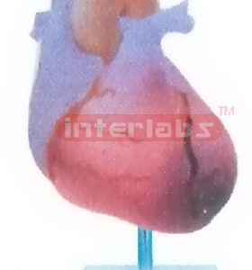 MYOCARDIAL INFARCTION MODEL