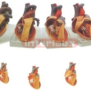 HUMAN COMMON PATHOLOGIES OF CONGENITAL ORGANIC HEART DEFECTS WITH HORIZONTAL BASE