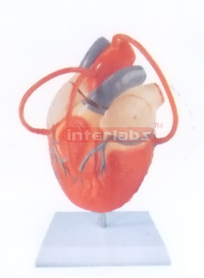 MIDDLE HEART MODEL WITH BYPASS