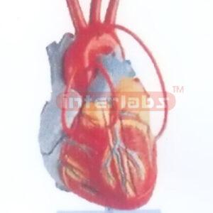 MIDDLE HEART MODEL WITH BYPASS